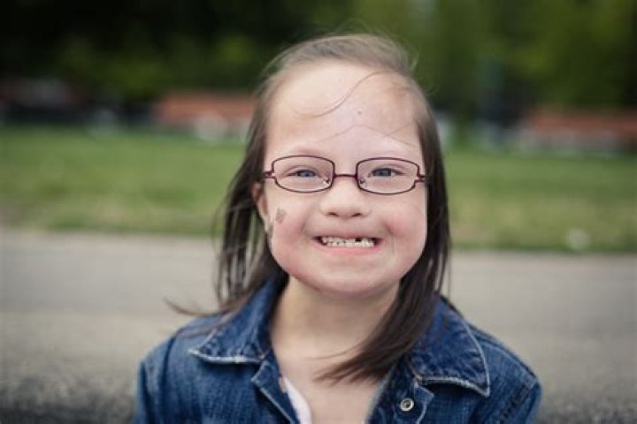 Embracing Life With Down Syndrome