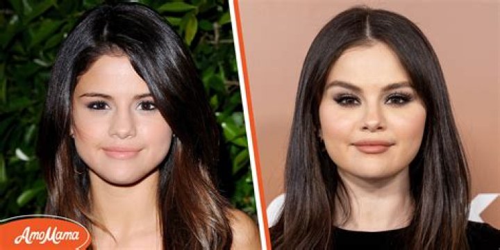 How Selena Gomez Transformed Her Look Before Surgery
