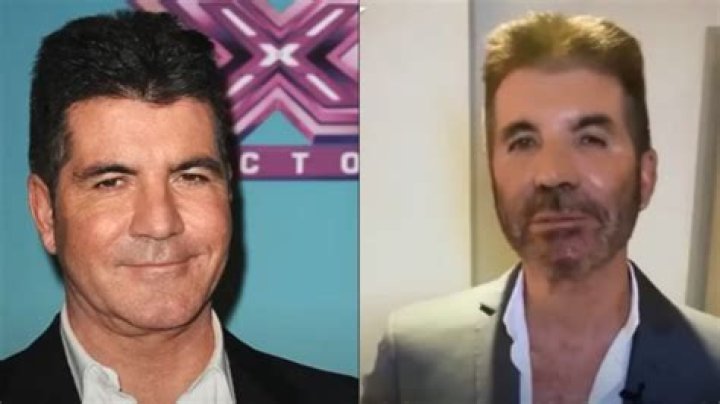 Simon Cowell Diagnosed With Mysterious Condition