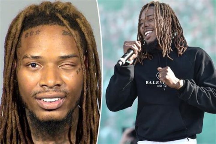 The Enigma Of Fetty Wap's Ocular Anomaly