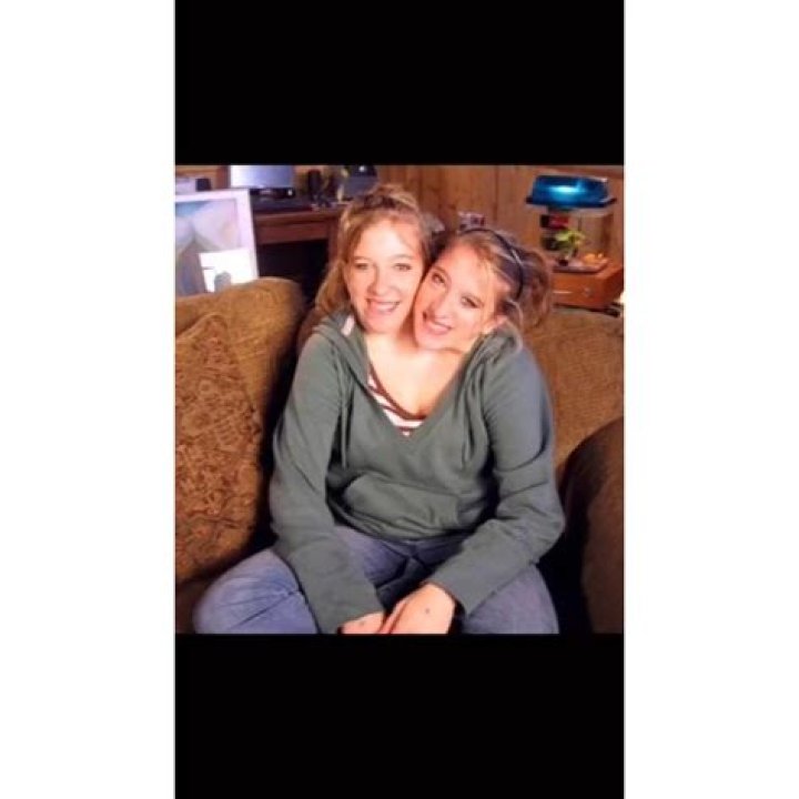 The Tragic Tale Of The Hensel Twins: Abby And Brittany